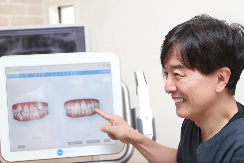 矯正歯科治療の事前シミュレーション